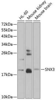 Western Blot: SNX3 AntibodyBSA Free [NBP2-94092]