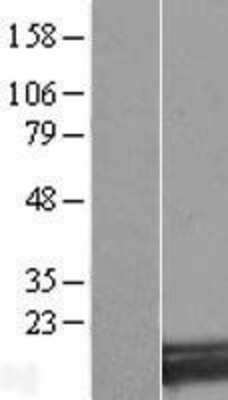 Western Blot: SNX3 Overexpression Lysate [NBL1-16314]