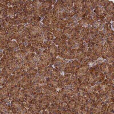 Immunohistochemistry: SNX33 Antibody [NBP1-81125]