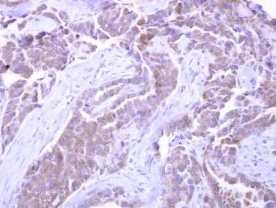 Immunohistochemistry-Paraffin: SNX33 Antibody [NBP2-20447]