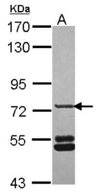 Western Blot: SNX33 Antibody [NBP2-20447]