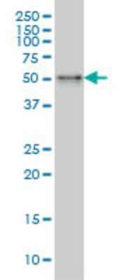 Western Blot: SNX4 Antibody (4H8) [H00008723-M01]