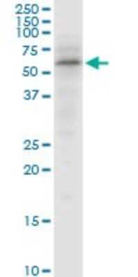 Western Blot: SNX4 Antibody [H00008723-B01P]