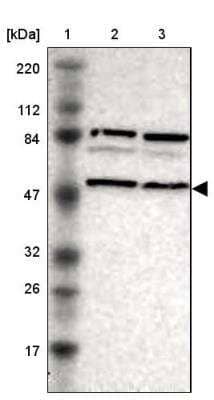 Western Blot: SNX4 Antibody [NBP1-88882]