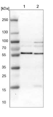 Western Blot: SNX4 Antibody [NBP1-88882]