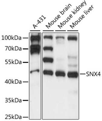 Western Blot: SNX4 AntibodyAzide and BSA Free [NBP2-94704]