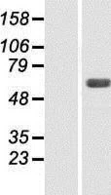 Western Blot: SNX4 Overexpression Lysate [NBP2-07953]