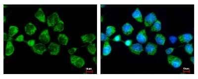 Immunocytochemistry/ Immunofluorescence: SNX5 Antibody [NBP2-20449]