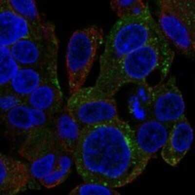 Immunocytochemistry/ Immunofluorescence: SNX5 Antibody [NBP3-17936]
