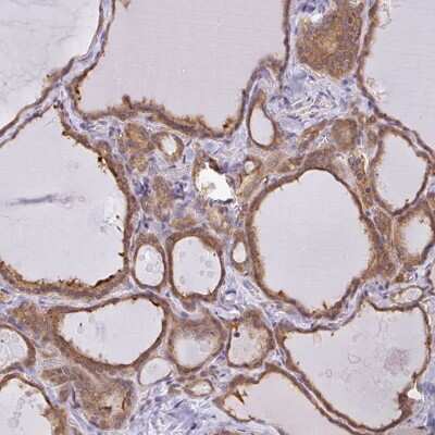 Immunohistochemistry-Paraffin: SNX5 Antibody [NBP2-38641]