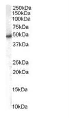 Western Blot: SNX5 Antibody [NB100-1362]