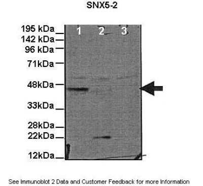 Western Blot: SNX5 Antibody [NBP1-58340]