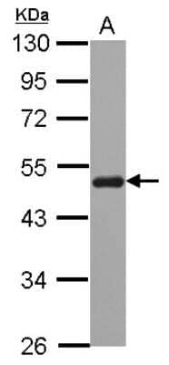 Western Blot: SNX5 Antibody [NBP2-20448]