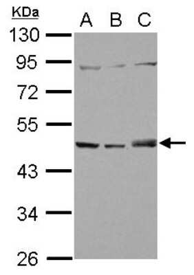 Western Blot: SNX5 Antibody [NBP2-20449]