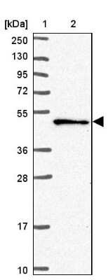 Western Blot: SNX5 Antibody [NBP2-38641]