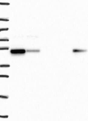 Western Blot: SNX5 Antibody [NBP3-17936]