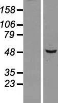 Western Blot: SNX5 Overexpression Lysate [NBL1-16319]