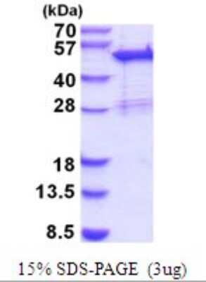 SDS-PAGE: Recombinant Human SNX5 His Protein [NBP2-52068]