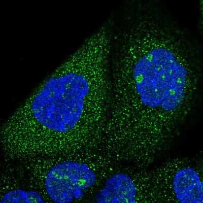 Immunocytochemistry/ Immunofluorescence: SNX7 Antibody [NBP2-55435]