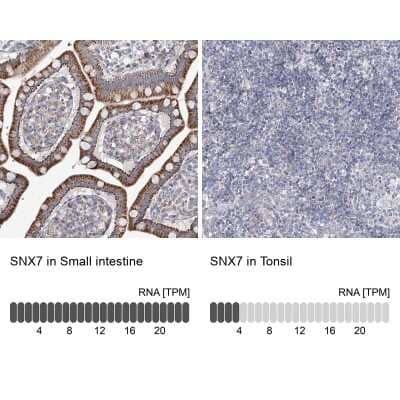 Immunohistochemistry-Paraffin: SNX7 Antibody [NBP1-86276]