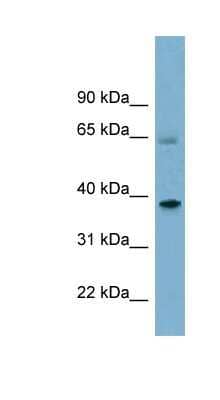 Western Blot: SNX7 Antibody [NBP1-58862]