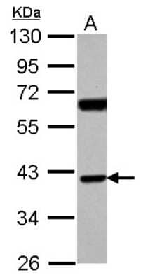 Western Blot: SNX7 Antibody [NBP2-20450]