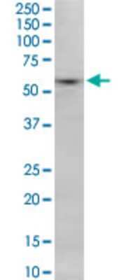 Western Blot: SNX8 Antibody (3B6) [H00029886-M08]