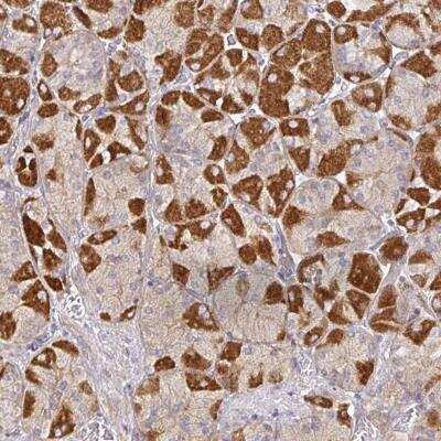 Immunohistochemistry-Paraffin: SNX8 Antibody [NBP2-31808]