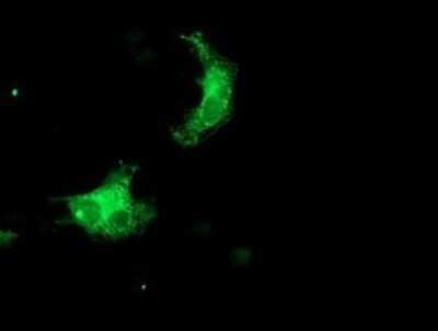 Immunocytochemistry/ Immunofluorescence: SNX8 Antibody (OTI1A1) - Azide and BSA Free [NBP2-74265]