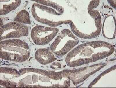 Immunohistochemistry: SNX8 Antibody (OTI1A1) - Azide and BSA Free [NBP2-74265]