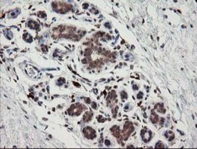 Immunohistochemistry: SNX8 Antibody (OTI1A1) - Azide and BSA Free [NBP2-74265]