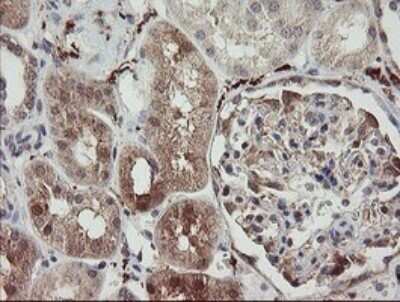 Immunohistochemistry: SNX8 Antibody (OTI1A1) - Azide and BSA Free [NBP2-74265]