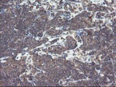 Immunohistochemistry: SNX8 Antibody (OTI1A1) [NBP2-45896]