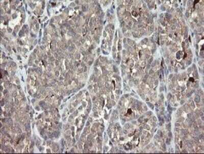 Immunohistochemistry: SNX8 Antibody (OTI1A1) [NBP2-45896]
