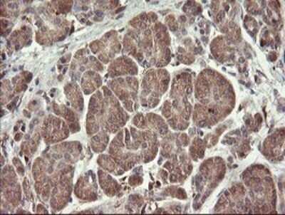 Immunohistochemistry: SNX8 Antibody (OTI1A1) [NBP2-45896]