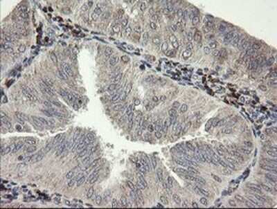 Immunohistochemistry: SNX8 Antibody (OTI1A1) [NBP2-45896]