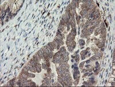 Immunohistochemistry: SNX8 Antibody (OTI1A1) [NBP2-45896]