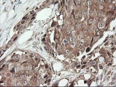 Immunohistochemistry: SNX8 Antibody (OTI1A1) [NBP2-45896]