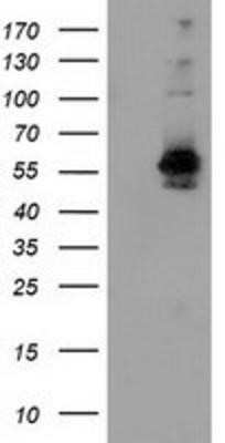 Western Blot: SNX8 Antibody (OTI1E5)Azide and BSA Free [NBP2-74266]