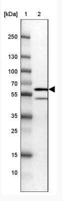 Western Blot: SNX8 Antibody [NBP2-31672]