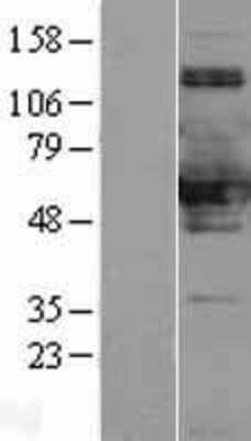 Western Blot: SNX8 Overexpression Lysate [NBL1-16322]