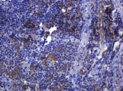 Immunohistochemistry: SOAT 2 Antibody (OTI2D3) [NBP2-45981]