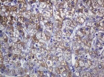 Immunohistochemistry: SOAT 2 Antibody (OTI2D3) [NBP2-45981]