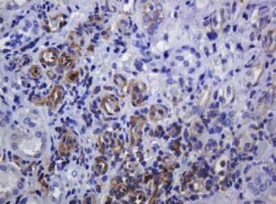 Immunohistochemistry: SOAT 2 Antibody (OTI2D3) [NBP2-45981]
