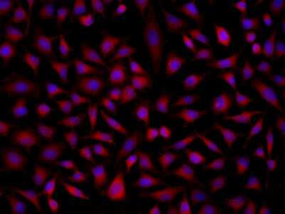 Immunocytochemistry/ Immunofluorescence: SOAT 2 Antibody [NBP3-06319]