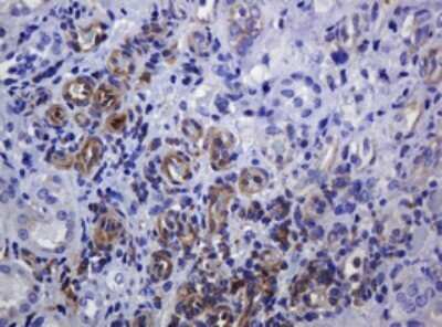 Immunohistochemistry: SOAT 2 Antibody (OTI2D3) - Azide and BSA Free [NBP2-74271]