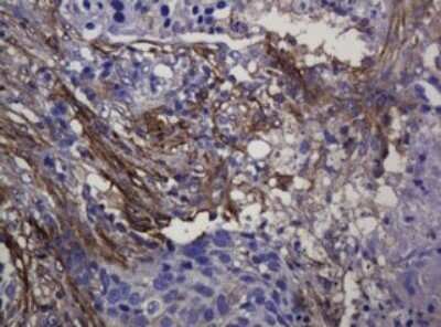 Immunohistochemistry: SOAT 2 Antibody (OTI2D3) - Azide and BSA Free [NBP2-74271]