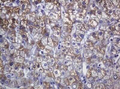 Immunohistochemistry: SOAT 2 Antibody (OTI2D3) - Azide and BSA Free [NBP2-74271]