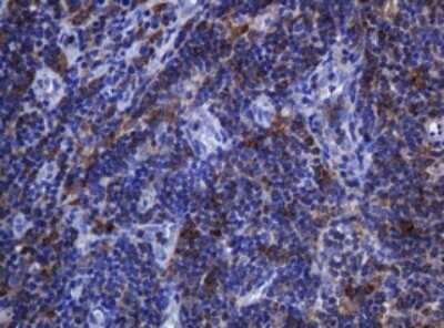 Immunohistochemistry: SOAT 2 Antibody (OTI2D3) - Azide and BSA Free [NBP2-74271]