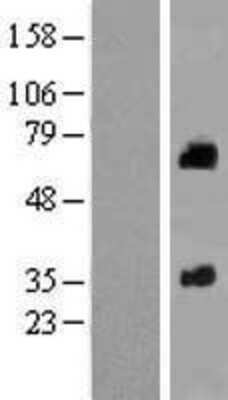 Western Blot: SOAT 2 Overexpression Lysate [NBP2-10598]